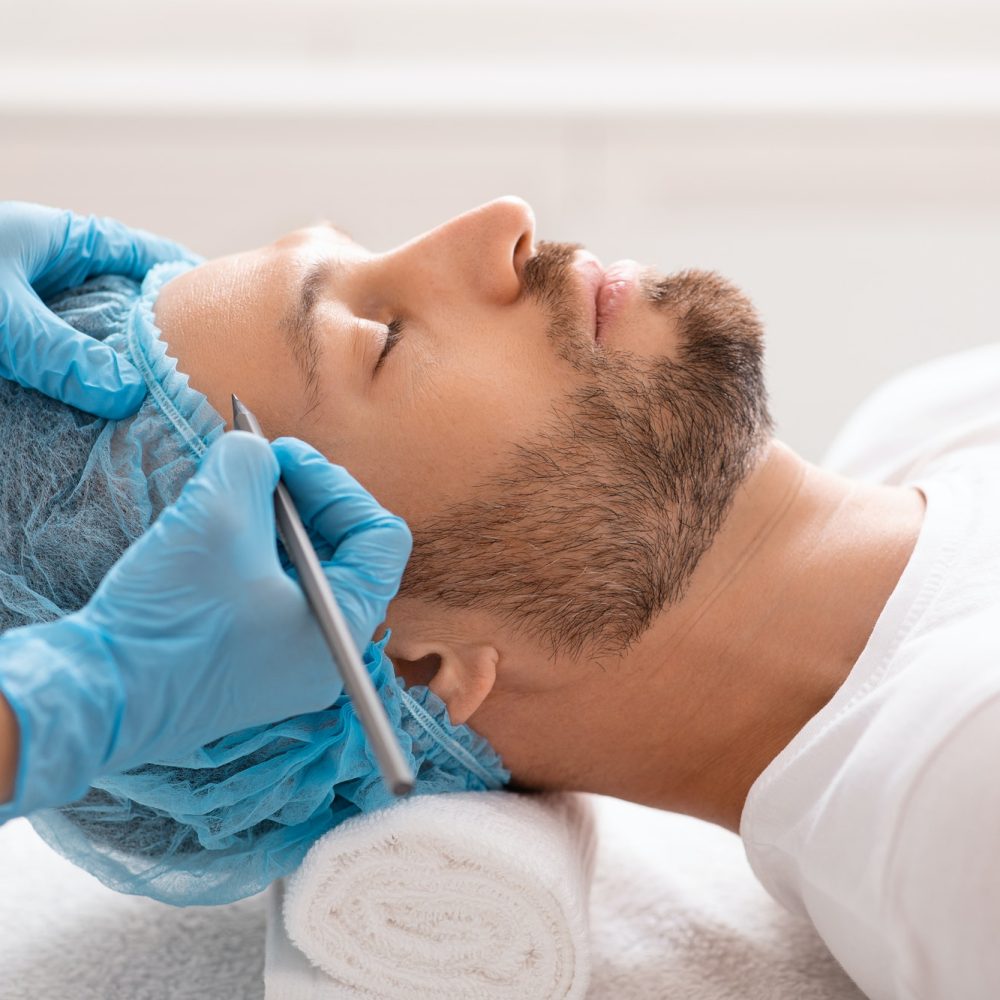handsome-man-getting-pencil-marks-on-forehead-before-surgery.jpg